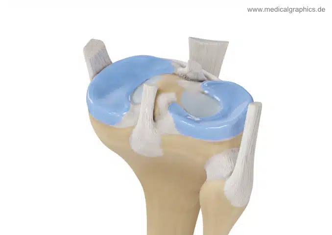 Menisken von lateral hinten Menisken, Osteopathie