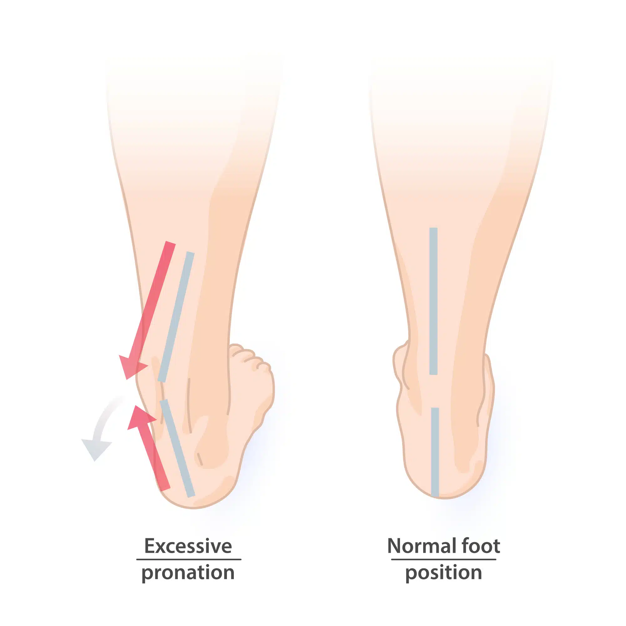 pronation, Knieschmerzen, Osteopathie